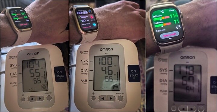 Imagen - Comparativa: Huawei Watch D2 vs tensiómetro médico para medir la tensión arterial