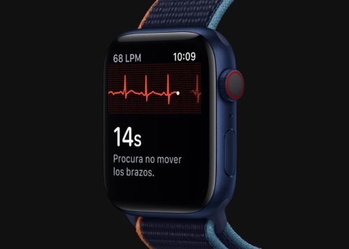 El sensor cardíaco del Apple Watch satura las consultas médicas