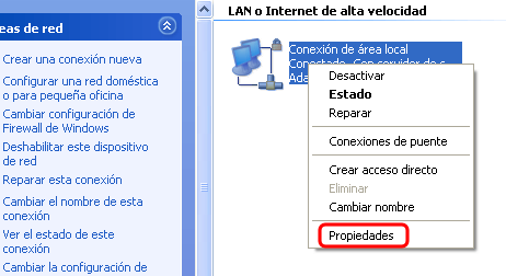 Imagen - Cambiar DNS en Windows XP