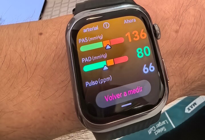 Imagen - Huawei Watch D2, análisis con opinión y ficha técnica