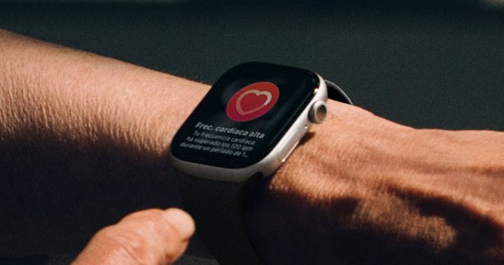 Imagen - Apple Watch Series 11: diseño continuista y pocas novedades